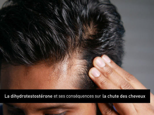 La dihydrotestostérone et ses conséquences sur la chute de cheveux